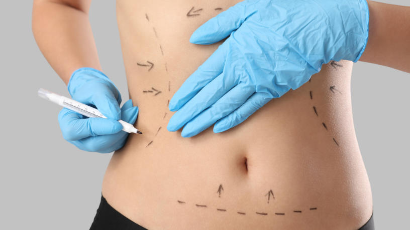 A relevância do acompanhamento emocional antes da cirurgia plástica é destacada por Dr. Milton Seigi Hayashi.